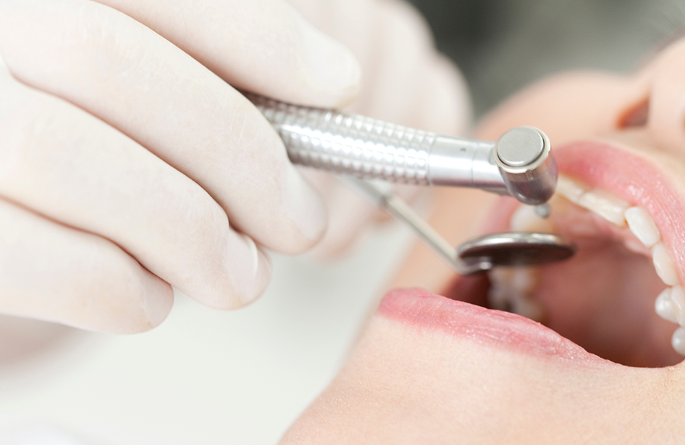 総合的な歯の治療